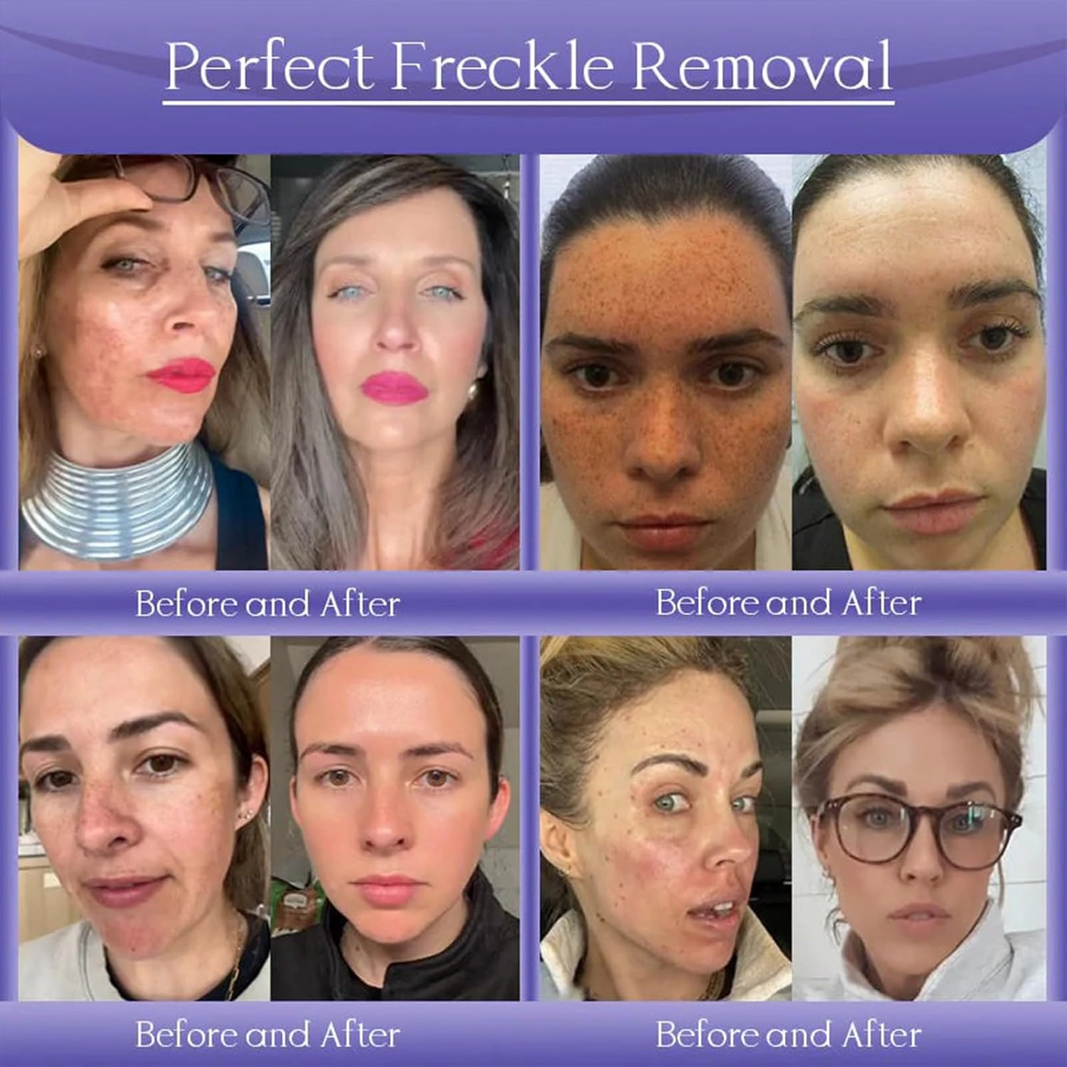 Anti-Wrinkle Skin Cream for Remove Wrinkles, Firms Skin,Effectively Improve skin Quality (4PCS)