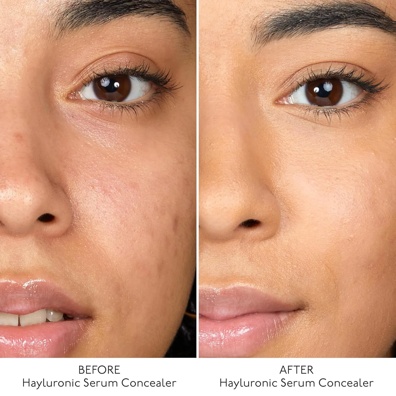 By Terry Hyaluronic Serum Concealer, Radiant & Hydrating Skincare-Infused Concealer, Buildable Coverage, Vegan, Golden Nude