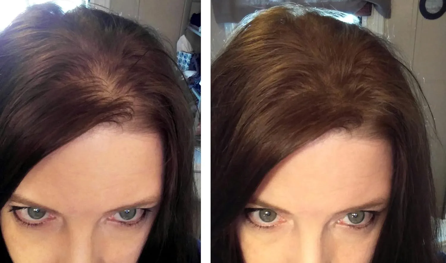 Caboki Hair Loss Concealer (All-Natural Hair Building Fibers) Travel Size (Medium Brown)