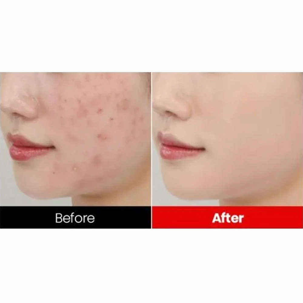 Dr.want Red Concealer 32ml