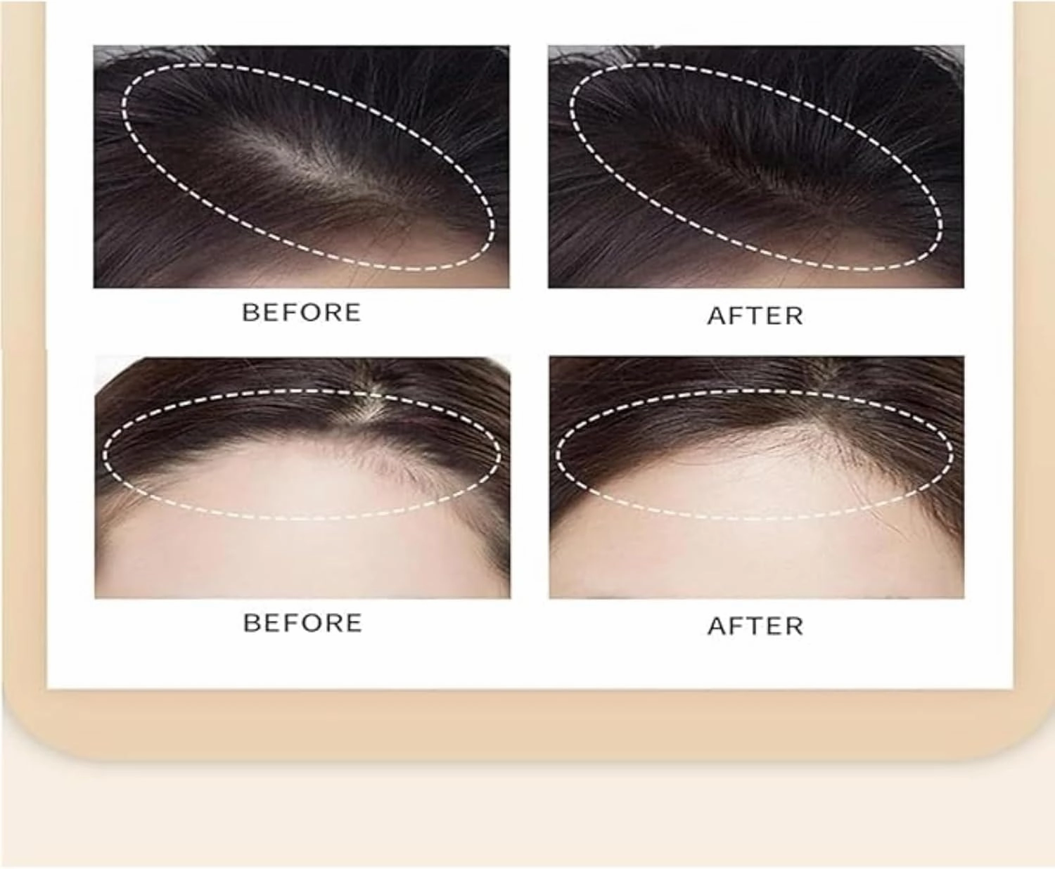 Hairfillup Hair Concealer, Sweat-Proof Waterproof Hair Concealer, Hairline Enhancing Powder for Men Women, Black