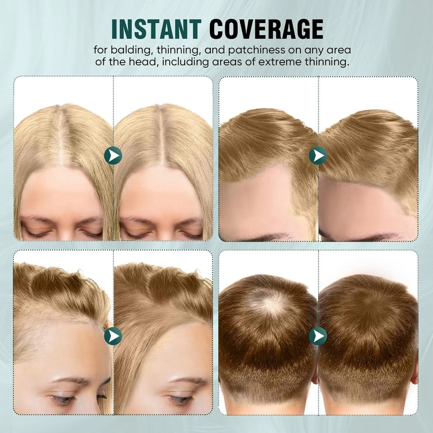 Hairline Powder 12g, Instantly Hair Root Touch Up, Hair Color Powder, Bald Spots Hair Color Concealer for Women & Men, 24-Hour Stain-Proof, Includes 2 Refills, for Thinning Hair, Medium Blonde