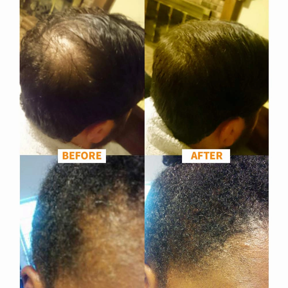 Keratin Hair Building Fibers: Hair Fiber Filler and Thickener for Men and Women - Cover Up and Concealer for Thinning Areas or Minor Bald Spot - Thicker, Fuller Hair in Seconds - 25 grams