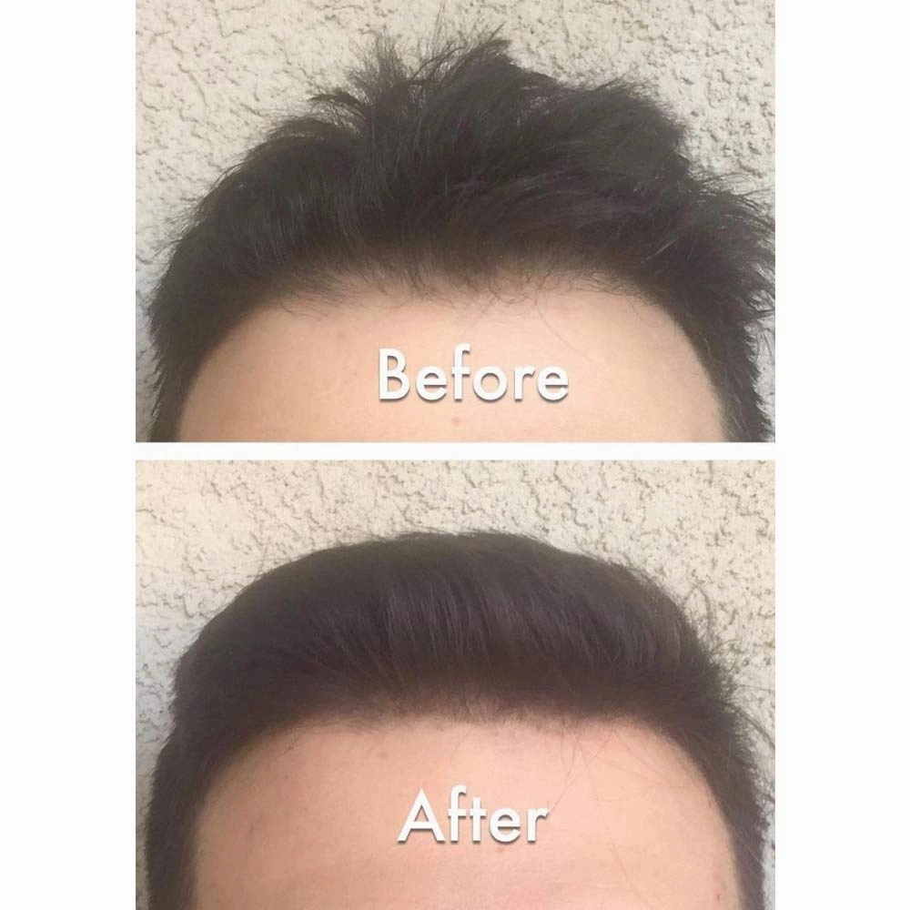 Keratin Hair Building Fibers: Hair Fiber Filler and Thickener for Men and Women - Cover Up and Concealer for Thinning Areas or Minor Bald Spot - Thicker, Fuller Hair in Seconds - 25 grams