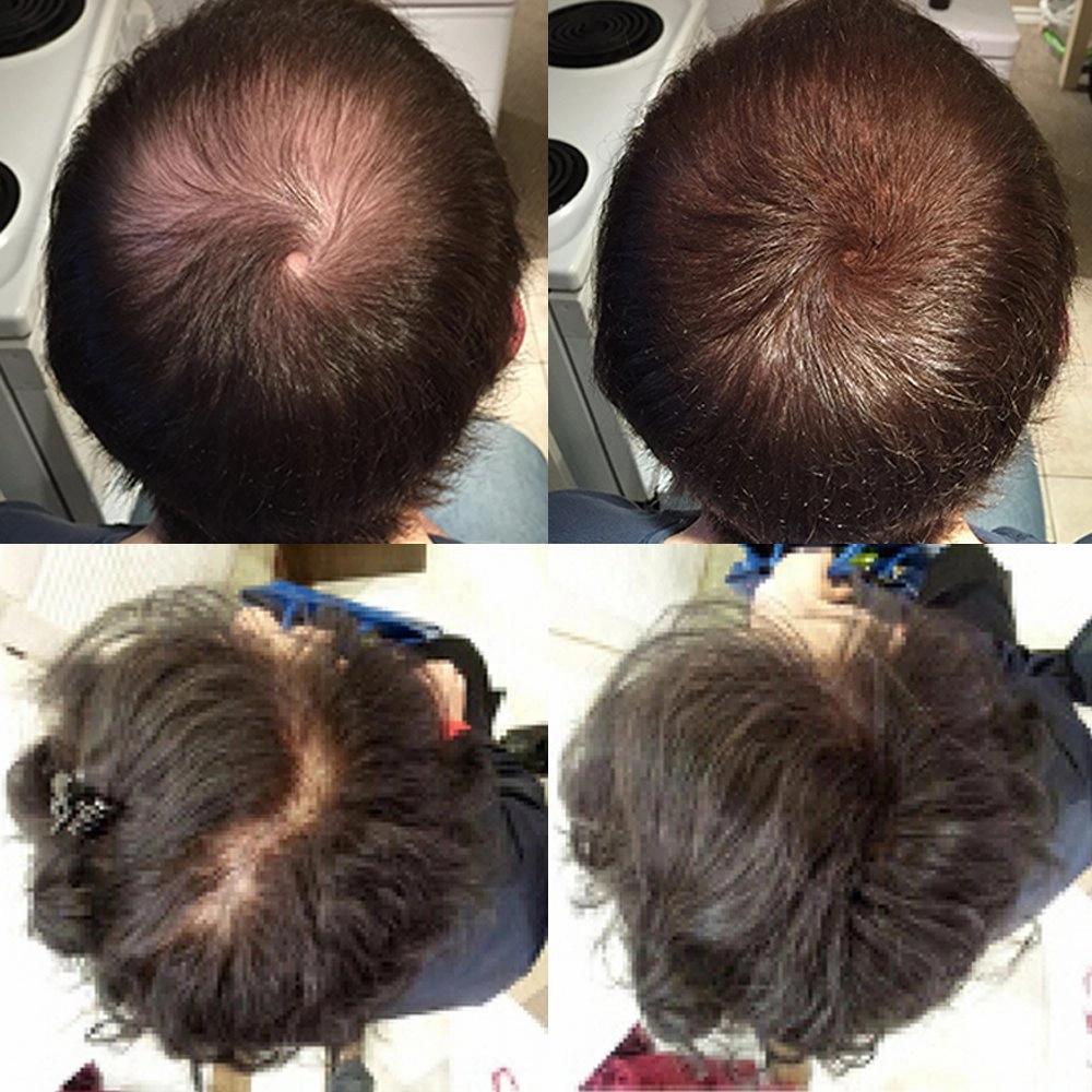 Keratin Hair Building Fibers: Hair Fiber Filler and Thickener for Men and Women - Cover Up and Concealer for Thinning Areas or Minor Bald Spot - Thicker, Fuller Hair in Seconds - 25 grams
