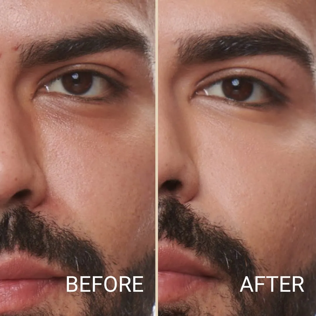MATTR Skin Fix - Luxury - Easy for Men - Tinted Concealer - Visibly Covers Fine Lines, Under-Eye Bags, Razor Burns, Pimples - Vegan Makeup - Perfect for Gym Bag or Travel - 15g (L1)