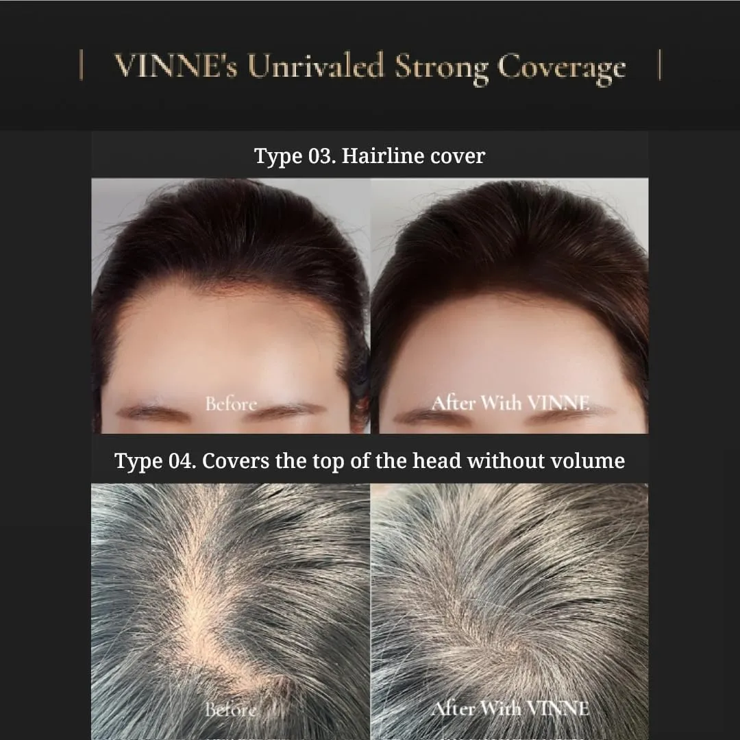 Vinne 2-Color Hair Cushion Stick: Waterproof Gray Cover, Long-Lasting Root Filler & Nutrient-Rich Care (Natural Black, Dark Brown)